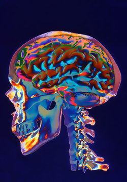 brain.jpg